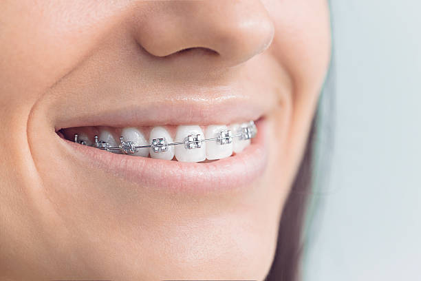 Best Traditional Braces  in Pea Ridge, FL